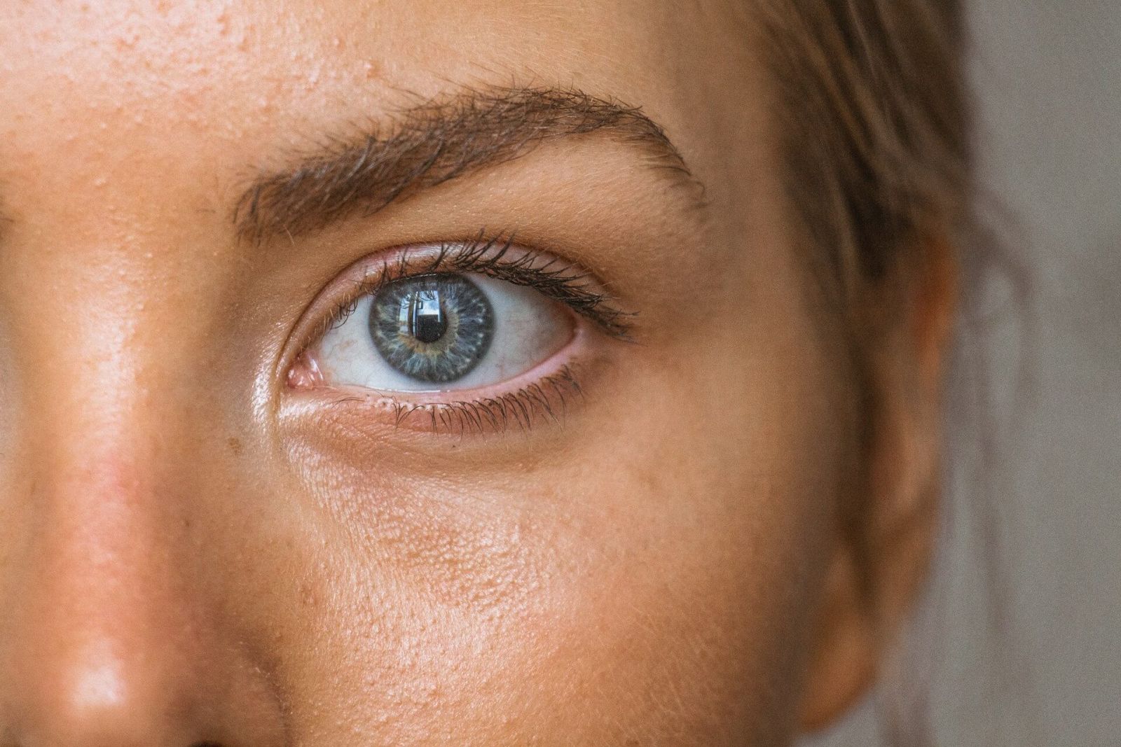 Hidratarea tenului gras solutii pentru o piele fara acnee ten ochi